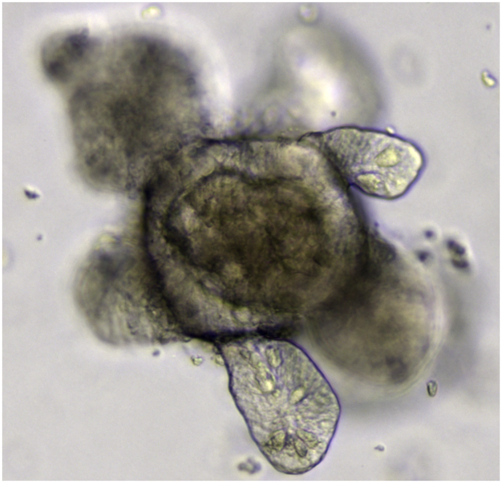 “Mini Organs” Could Change How We Treat Diseases from Cystic Fibrosis to Cancer